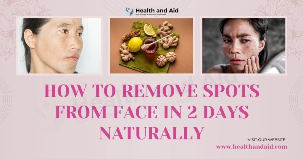 How to Remove Spots from Face in 2 Days Naturally